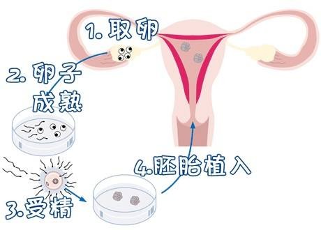 42岁二胎